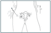 diagram to accompany text