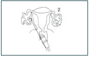diagram to accompany text