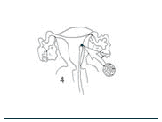 diagram to accompany text
