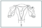 uterus