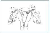 fallopian tubes