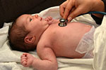 birth defects photo