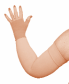 Picture of compression garment on swollen arm